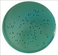 Hektoen Enteric Agar