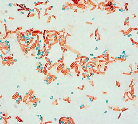spore-staining
