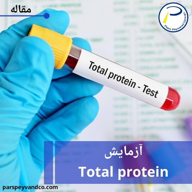 آزمایش توتال پروتئین
