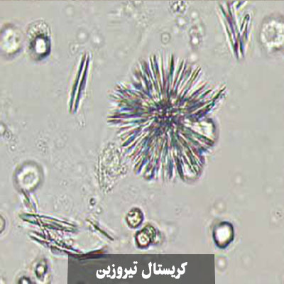 تیروزین