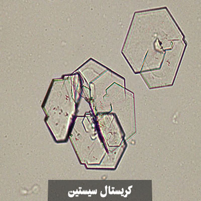 کریستال های سیستین